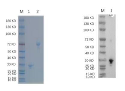 1. LRP6<br />2. BSA